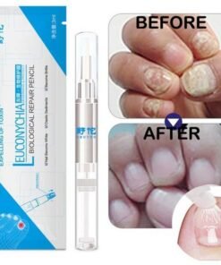 1Pcs Nail Fungal Treatment Pen Anti Fungus Infection Biological Repair Solution Nutritious Oil 3ml Restores Healthy Toenails
