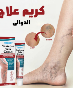 كريم علاج الدوالى