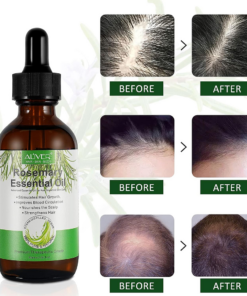 زيت أكليل الجبل لنمو الشعر - Growth Hair Rosemary Essential Oil