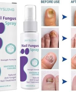 Nail Fungus Spray