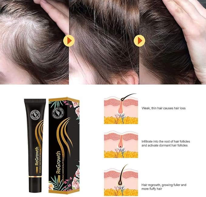 Organic Hair Growth Serum - الصورة 4